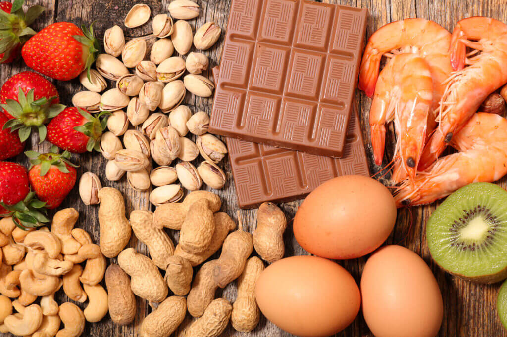 Allergien 1 Erdbeeren, Nüsse, Schokolade, Eier, Südfrüchte und Garnelen liegen auf einem Tisch. Alles Nahrungsmittel, die Allergien auslösen können.